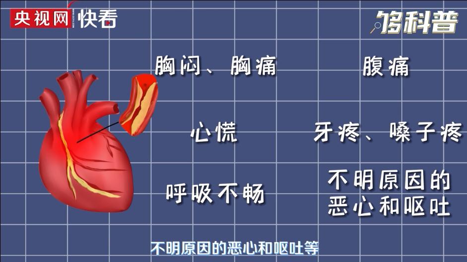 别不当回事!男子牙疼数日,没想到是心肌梗死