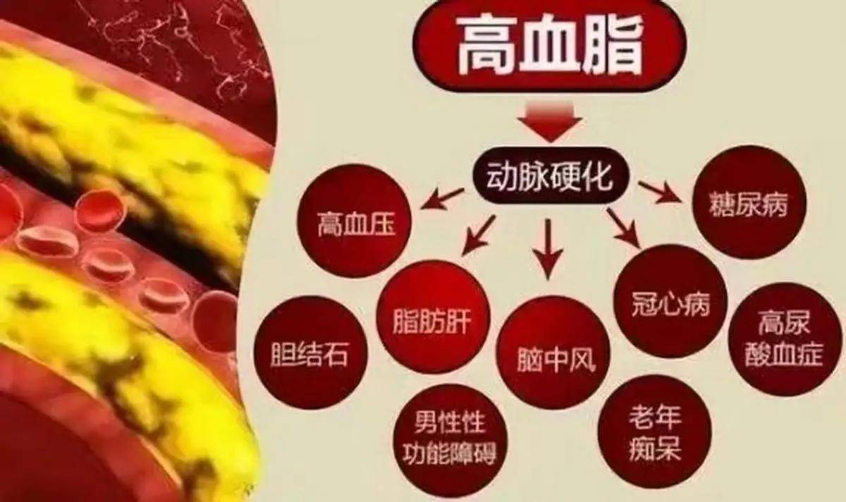 浙大发现:喝醋能在75小时内清除身体多半的血栓?这是真的吗?