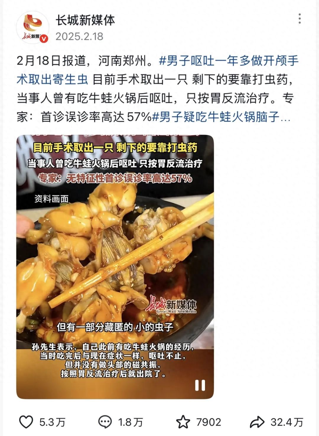 男子呕吐一年多，开颅手术取出寄生虫，原因是这种大家常吃的火