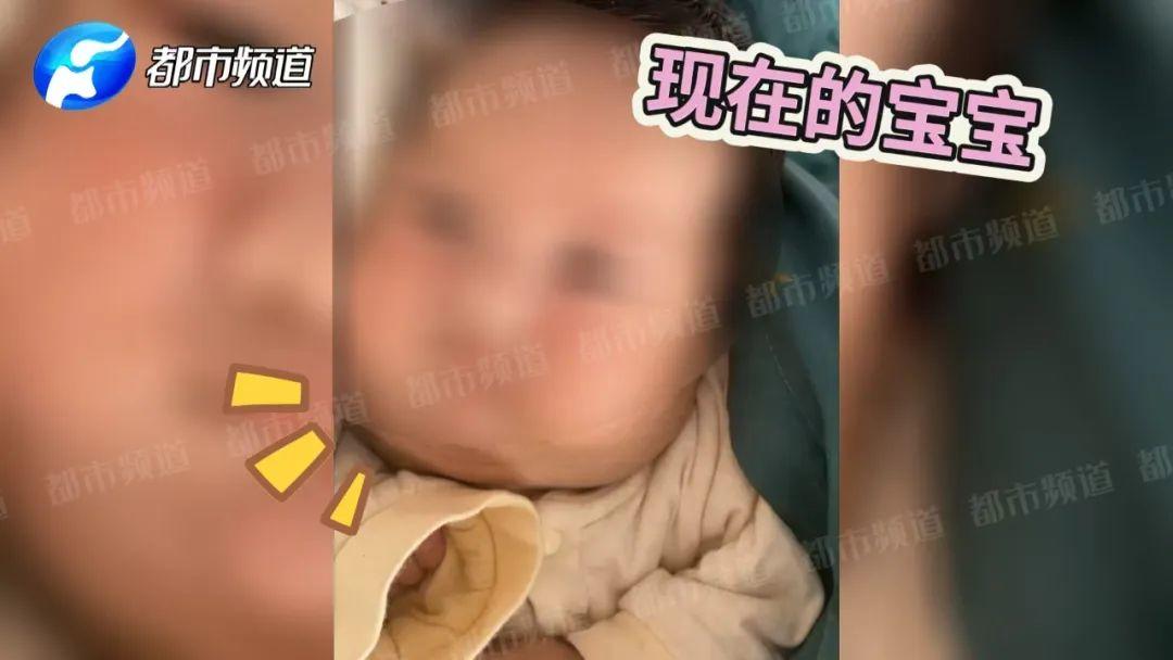 胎儿下颌长15cm巨物,比头还大!妈妈不忍引产,医生成功逆转生