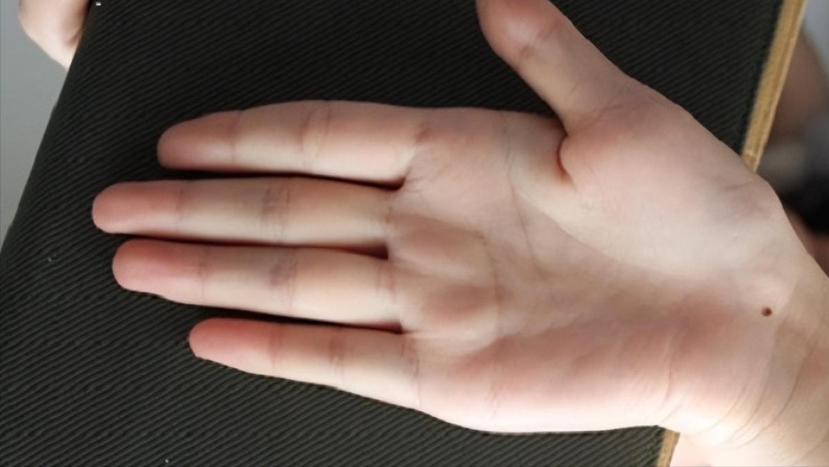 一斗穷,二斗富是真的吗?中科院发现斗和簸箕的基因奥秘今日